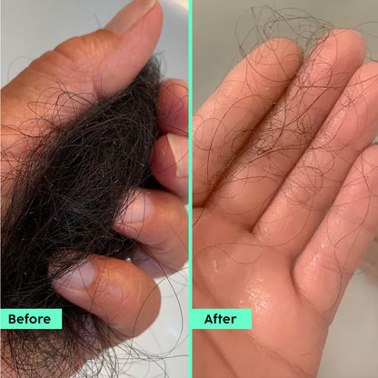 Rosemary Anti Hairfall Conditioner with 3% Shea Butter expert
